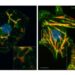 Treatment with ISRIB, a small molecule inhibitor