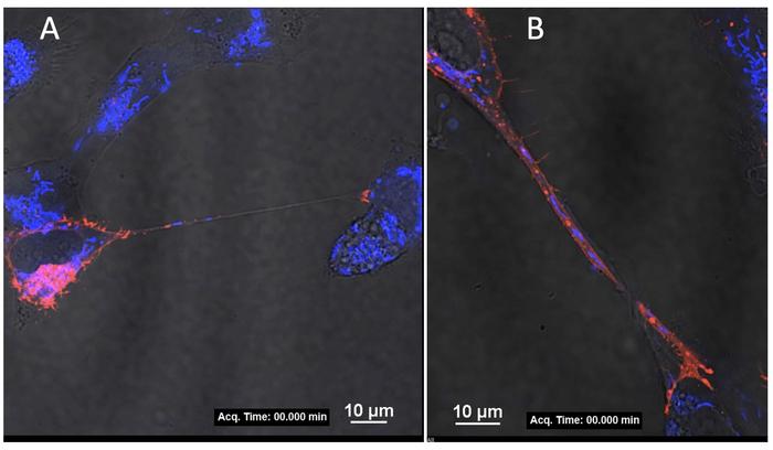 Zika virus nanotubes