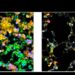 Adenocarcinoma cells