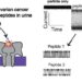 New Method Could Detect Early Ovarian Cancer from Urine Samples