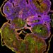 A transverse section through the Xenopus tadpole intersects multiple loops of the rotated intestine.