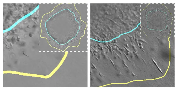 Tumor cells invading surrounding tissue under different mechanical conditions.