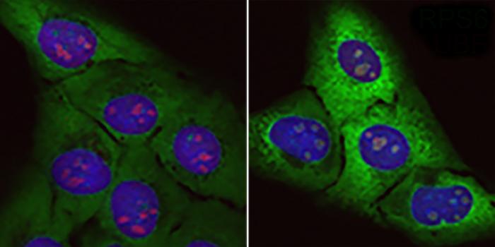 Accumulation of 'junk proteins' identified as one cause of aging and possible source of ALS