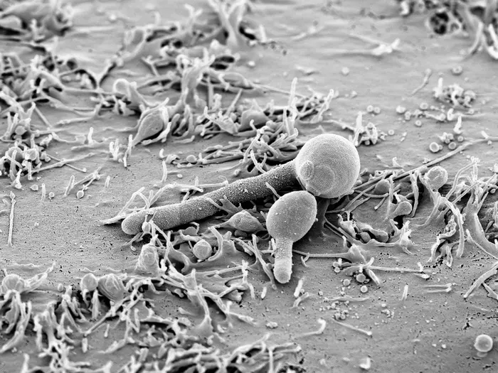 Candida albicans in the yeast and hyphae form