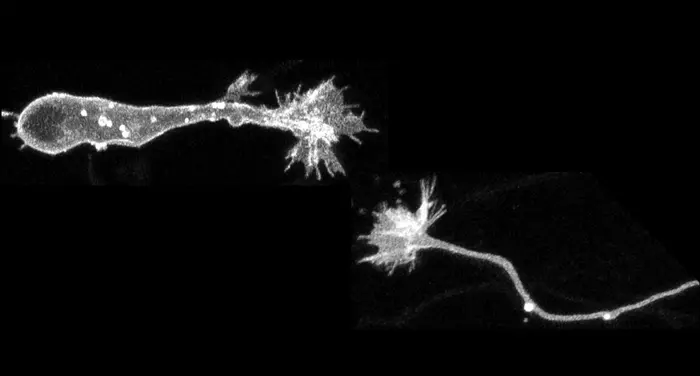 Neuronal growth cone