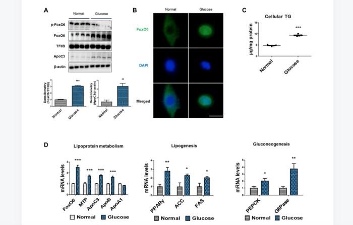 FoxO6-mediated ApoC3 upregulation promotes hepatic steatosis and hyperlipidemia in aged rats fed a high-fat diet