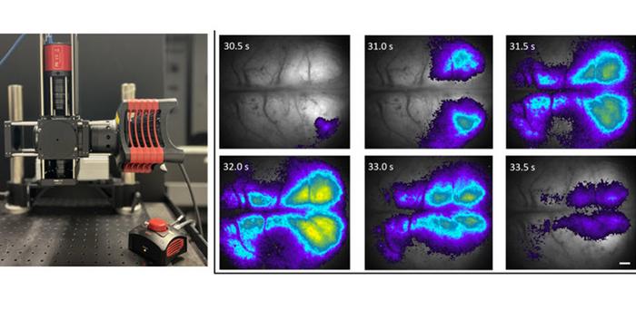 This newly developed modular mesoscope can be used for in vivo fluorescence imaging of rodent brains. It is versatile and can adjust to different experimental requirements while still providing exceptional neuroimaging performance.