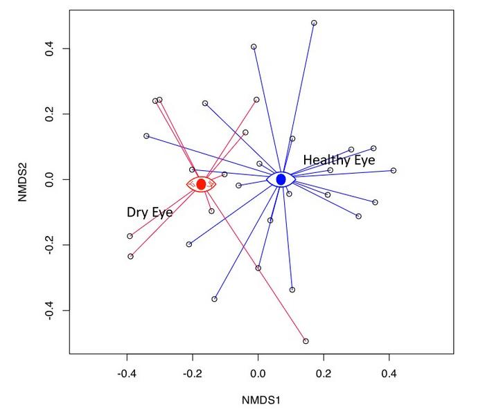 More than meets the eye: Researchers uncover the microbial secrets of dry eye