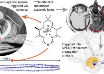 Overview of the seizure triggering electrodes and the brain reconstruction method.