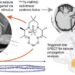 Overview of the seizure triggering electrodes and the brain reconstruction method.