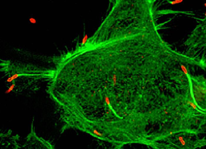 Burkholderia pseudomallei infecting a human cell