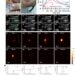 Real-Time Reconstruction of HIFU Focal Temperature Field Based on Deep Learning