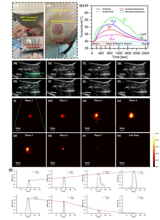 Real-Time Reconstruction of HIFU Focal Temperature Field Based on Deep Learning