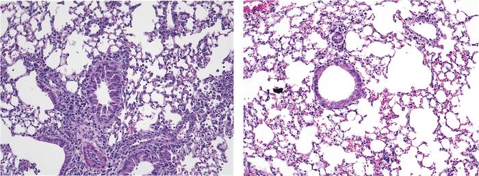 Yoda1 reduces lung inflammation