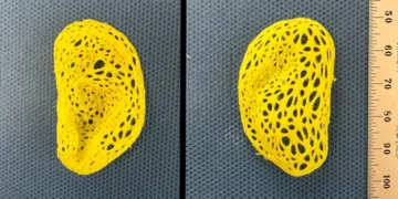 Pictured is the intricate, left-ear plastic scaffold that was created on a 3D printer based on data from a person’s ear, anterior view (left) and posterior view (right).