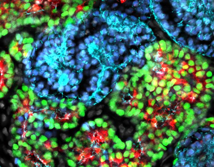 USC receives $3.95 million CIRM grant for organoid resource center