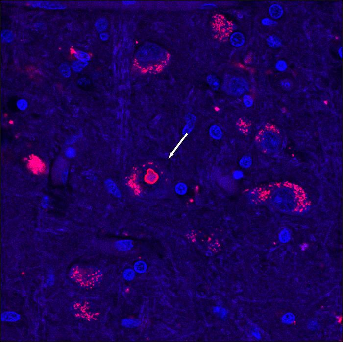 SCA4 brain tissue