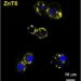 mAb43 (yellow) in beta cells