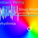 Arrhythmia_optogenetics