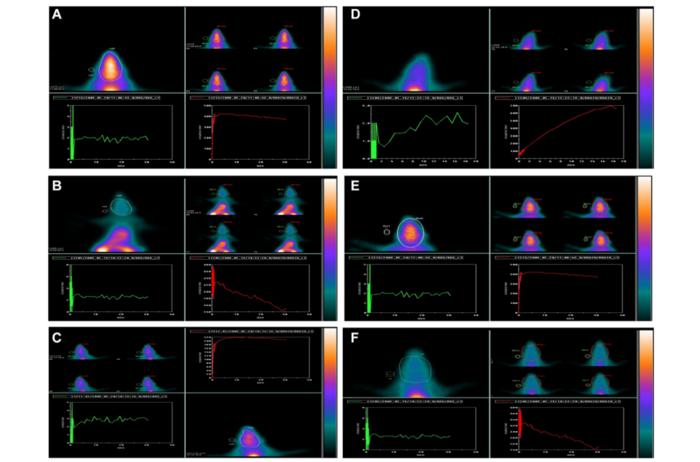 Geraniol attenuates oxidative stress and cognitive impairment in mouse aging model