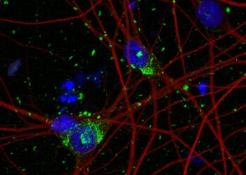 Staining of human stem-cell derived neurons shows DNA in cell nuclei (blue), neuron cytoskeleton (red), and tau aggregates (green)