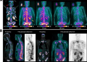 18F-DCFPyl PET/CT and 212Pb SPECT/CT Images