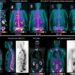 18F-DCFPyl PET/CT and 212Pb SPECT/CT Images