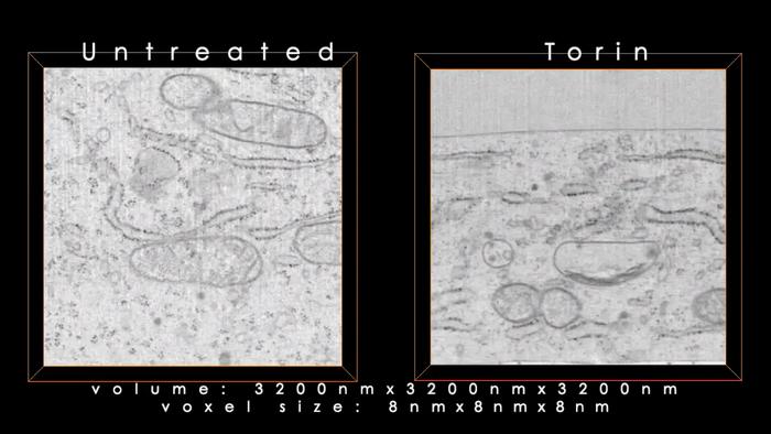 Starving cells hijack protein transport stations