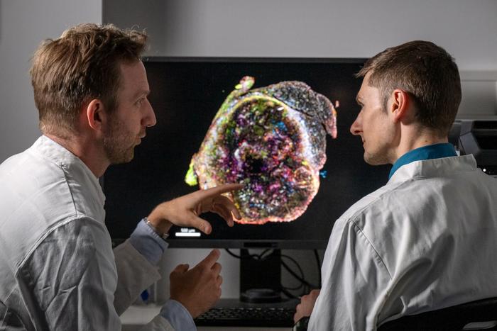 Dr. Jan Böttcher (left) and first author Sebastian Lacher (right): A team of researchers has discovered coverred a mechanism by which tumors prevent stem-like T cells from developing into cytotoxic T cells.