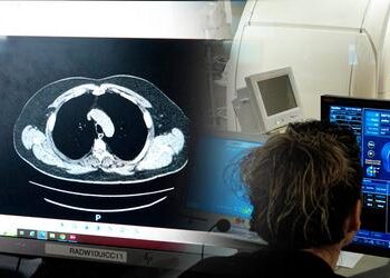 Lung Cancer Low-dose CT Screening