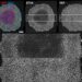 Microscopic depiction showcasing ETV4 expression dynamics in human embryonic stem cells influenced by variations in cell density