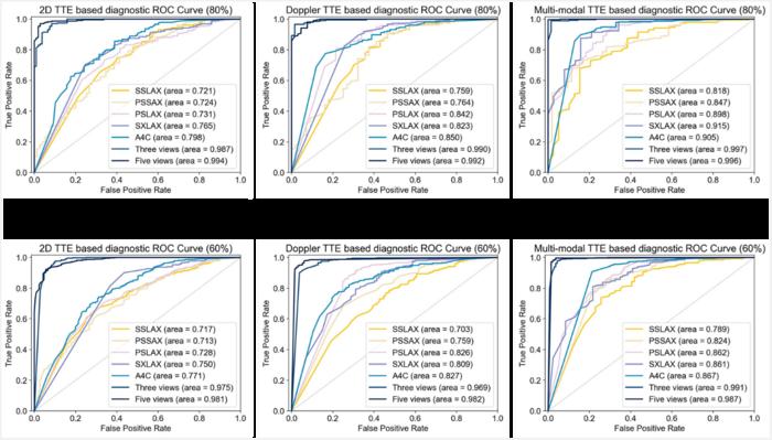 An auxiliary CHD diagnostic system based on multi-view and multi-modal transthoracic echocardiograms