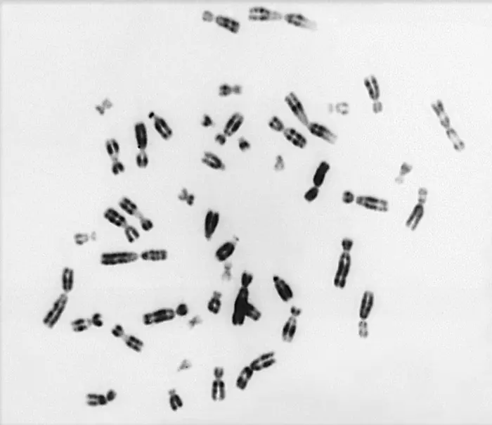 Human chromosomes