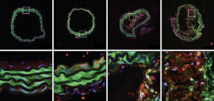 Hallmarks of Cancer