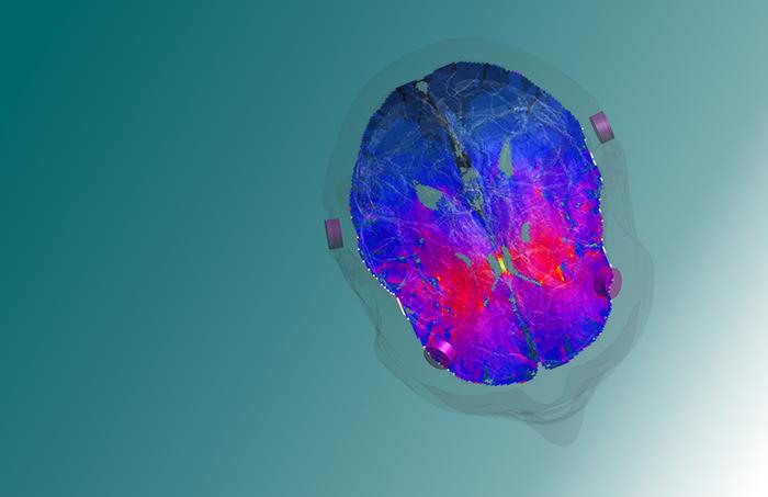 Non-invasive stimulation of the striatum