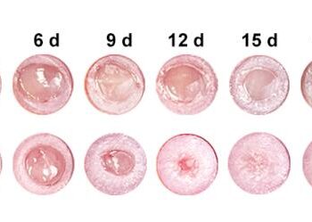 Nano Drug Accelerates Diabetic Wound Healing in Mice