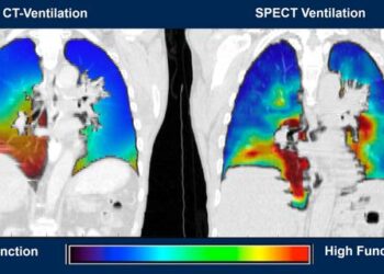 Lung Imaging