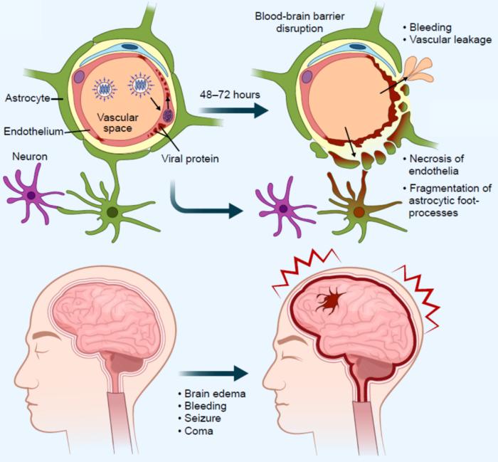 Promising new treatment strategy for deadly flu-related brain disorders