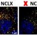 Study helps understand how energy metabolism is regulated at cellular level