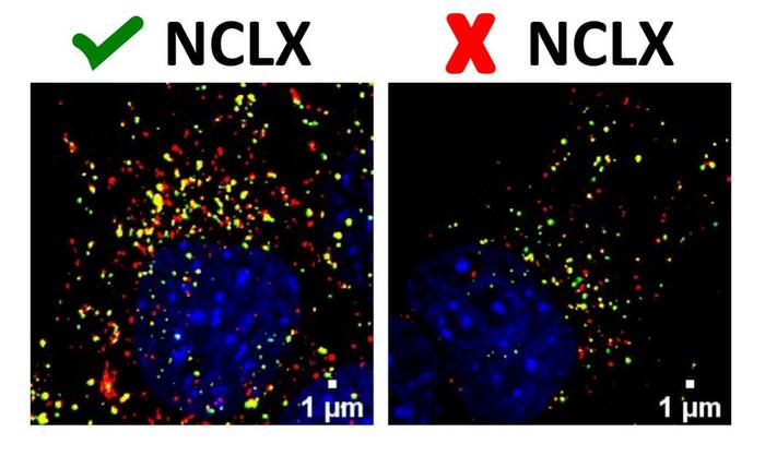 Study helps understand how energy metabolism is regulated at cellular level