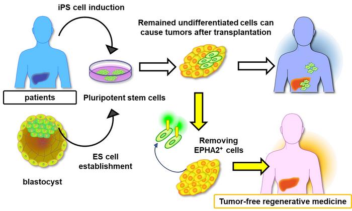 Tackling the hurdle of tumor formation in stem cell therapies