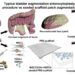 Bladder augmentation