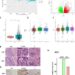 Expression of PFDN6 in patients with CRC.