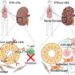 The role of autoinflammation in ciliopathies