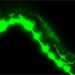 Malformed axonal growth cones in C. elegans worm