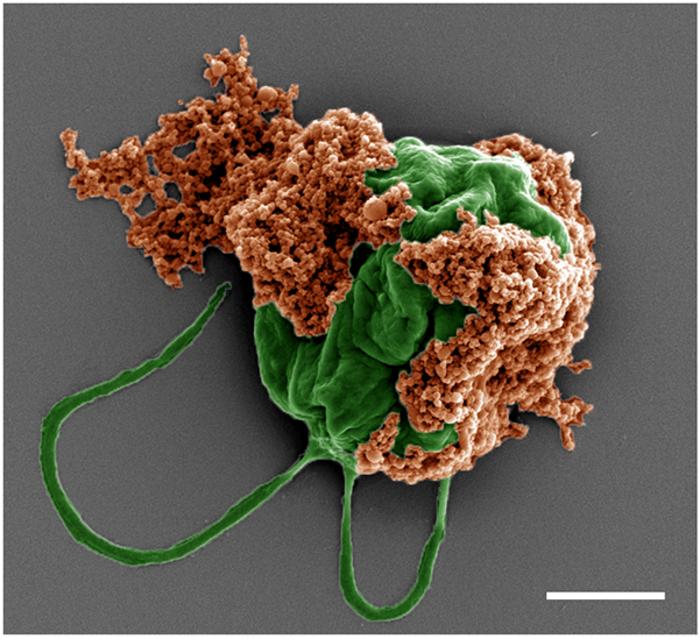 Microrobots treat lung metastasis - SEM