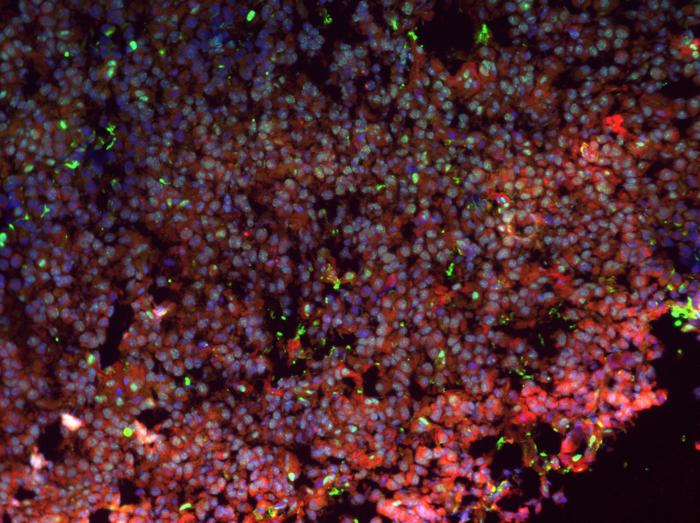 Immunofluorescence insulinoma