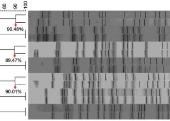 High genetic similarity in pathogenic E. coli isolated from urine and vagina of women with recurrent cystitis