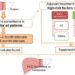 Follow-up and surveillance, recurrent modality, and adjuvant treatment strategy in patients with hepatocellular carcinoma (HCC) after curative hepatectomy or local ablation.