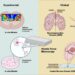 Atomic force microscopy in the characterization and clinical evaluation of neurological disorders